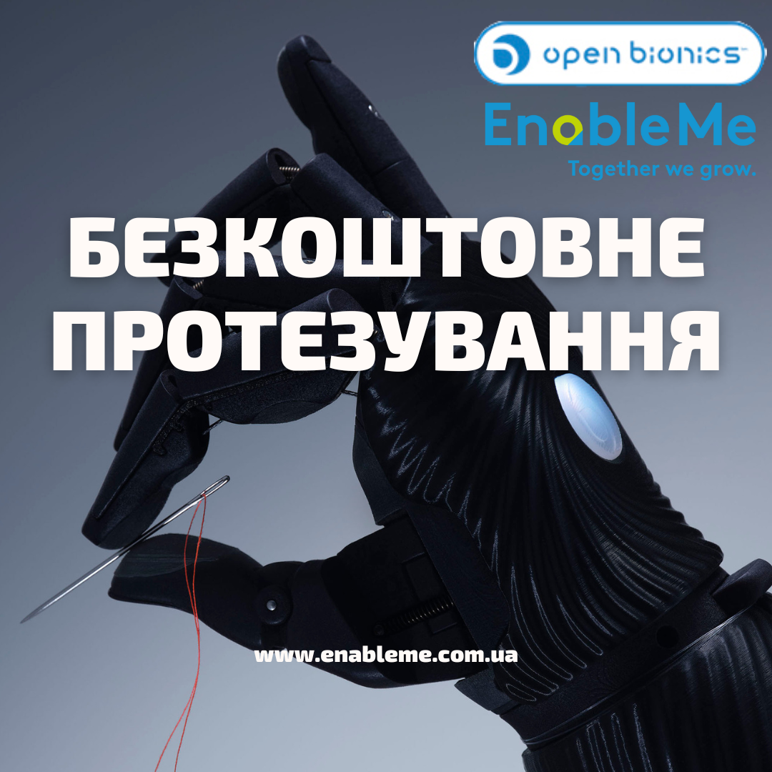 Як українцям отримати якісні біонічні протези безкоштовно?